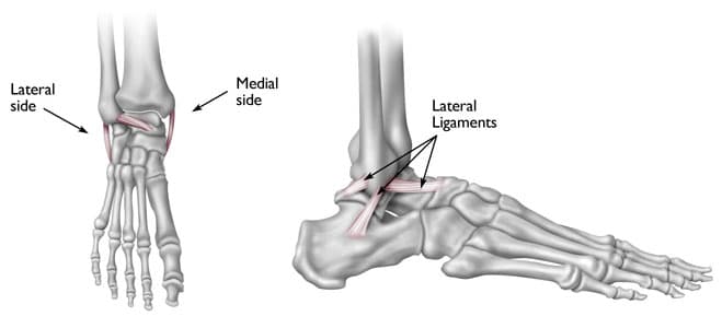 3 Levels of Ankle Sprains and How to Treat Them: Maryland Orthopedic  Specialists: Orthopedic Surgeons