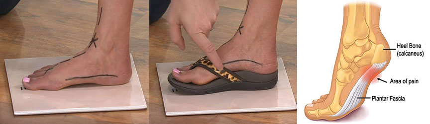 flip flops bad for feet