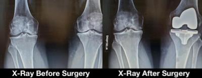 x-ray