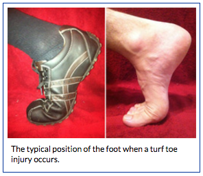 tendon from big toe to heel